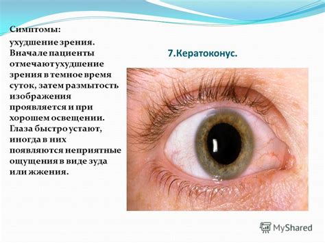 Научное объяснение феномена ощущения зуда в глазу