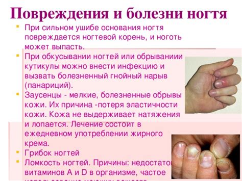 Недостаток необходимых веществ в организме - ключевая причина проблем со здоровьем ногтей