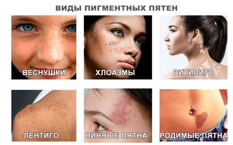 Неотразимые локти: избавляемся от нежелательных пигментных пятен