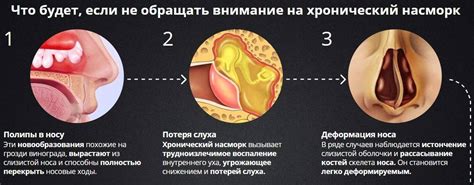 Неотъемлемая потребность слизистой оболочки носоглотки в увлажнении