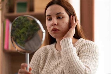 Несоблюдение гигиены и использование низкокачественных косметических средств