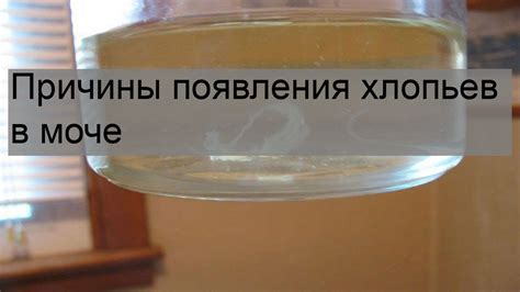 Обзор предпосылок появления протеина в моче у молодых людей