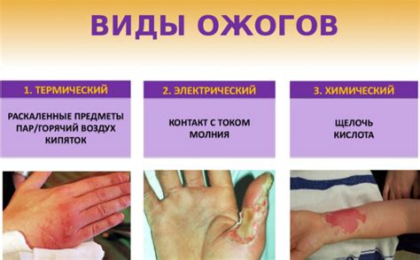 Обзор эффективных медицинских и народных способов лечения ожогов на лице