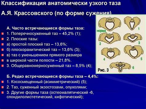 Обнаружение характерных признаков узкого таза при визуальном осмотре