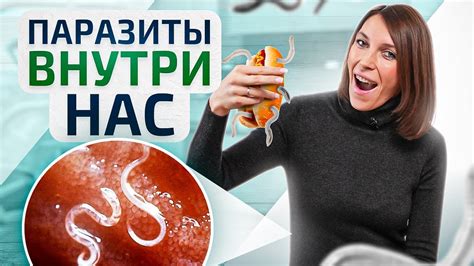 Общие проявления наличия паразитов в организме
