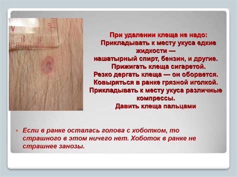 Обязательные правила при удалении пасти клеща внутри помещения