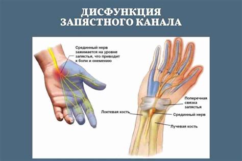 Описание и признаки защемления нерва