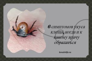Опознавание укуса осой и симптомов, указывающих на него