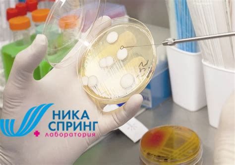 Определение и оценка консистенции мокроты: важный шаг в диагностике и лечении