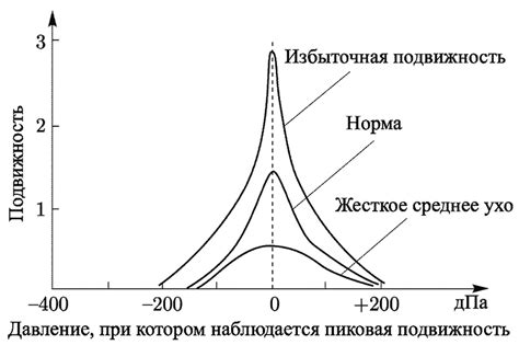 Определение и суть тимпанометрии тип А