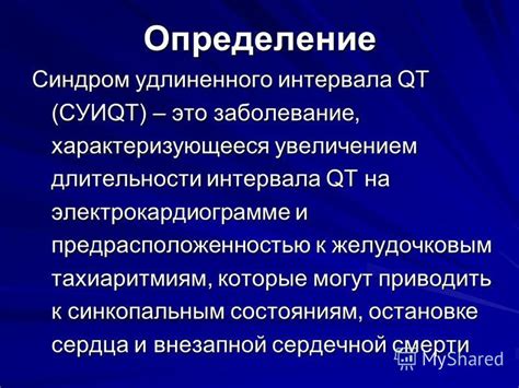 Определение особенности на электрокардиограмме