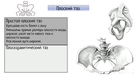 Определение типа таза: главные приемы и методы распознавания