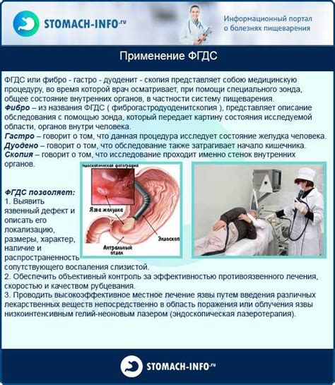 Организация процедуры: подготовка к ФГДС