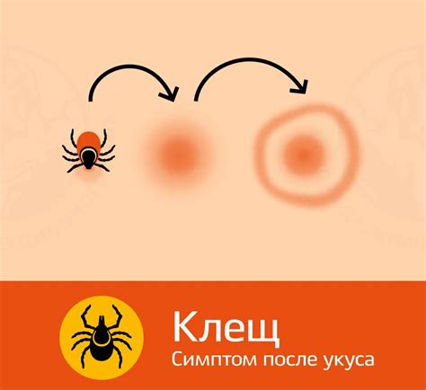 Осложнения после покуса клеща и их проявление