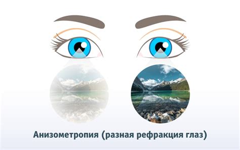 Осложнения при гнойных нитках в глазах