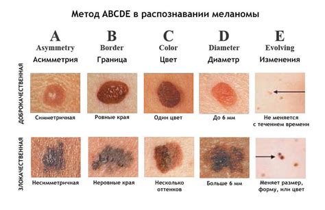 Осмотр и ощупывание кожи в поисках признаков образования гнойничка