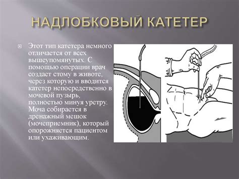 Основные аспекты процедуры восстановления здоровья мочевого органа