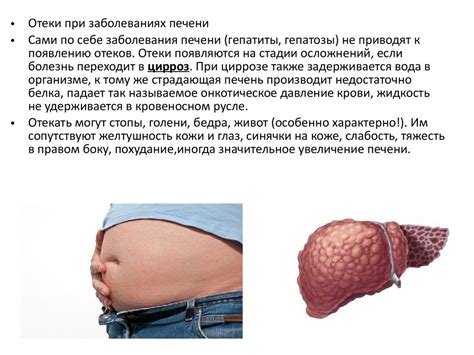 Основные заболевания, сопровождающиеся глюкозурией