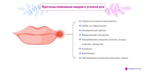 Основные методы терапии язв в уголках рта