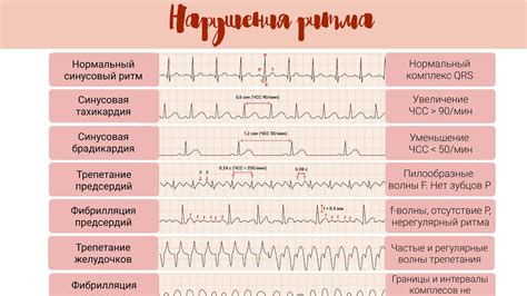 Основные показатели расположения петли сердца и их значение на ЭКГ