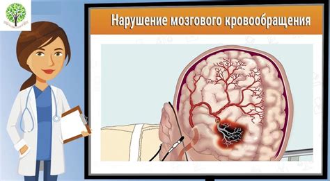 Основные признаки нарушения кровообращения в позвоночных нервах