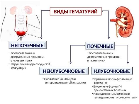 Основные признаки преграды в мочевых путях