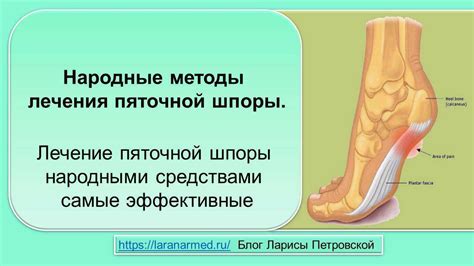 Основные причины возникновения дискомфорта на пятке при ношении кроссовок