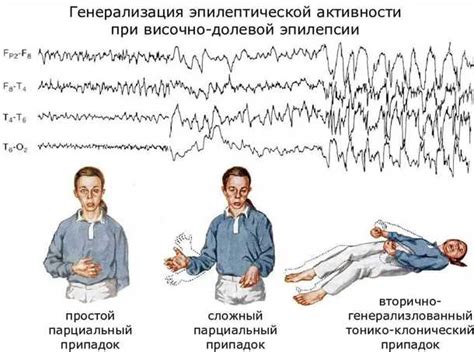 Основные причины возникновения эпилепсии у питомцев и эффективные профилактические меры