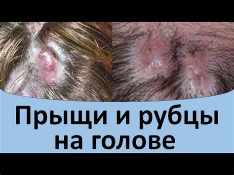 Основные причины гнойников