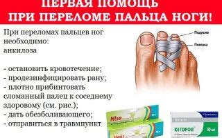 Основные причины травмирования мизинца на ноге и методы их предотвращения
