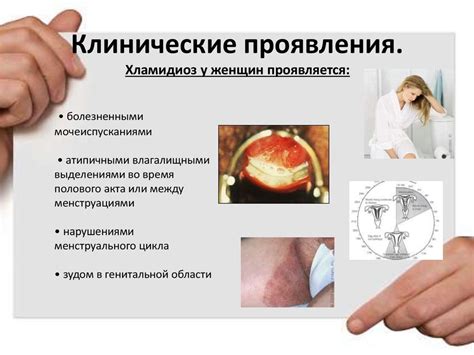 Основные проявления заболевания у человека