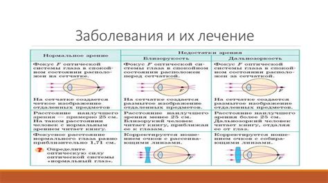 Основные свойства слепого места в зрении человека
