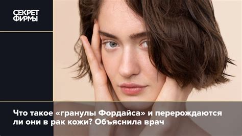 Основные симптомы и осложнения проявления гранул Фордайса