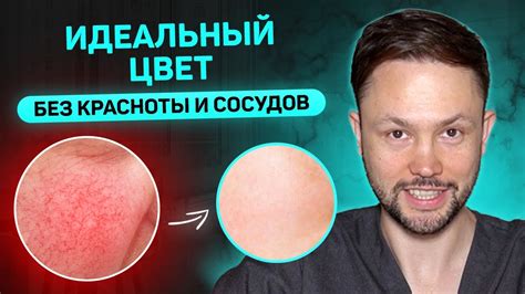 Основные способы и советы по устранению покраснений на коже