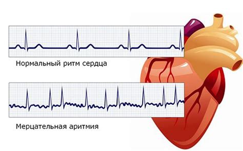 Основные факторы, влияющие на нормальный работу сердечного ритма