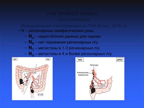 Основные факторы, вызывающие ритмичное пульсирование в области прямой кишки