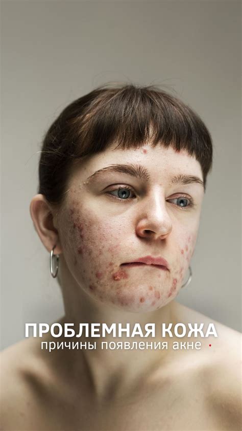 Основные факторы, способствующие появлению порезов и раздражений на бедрах