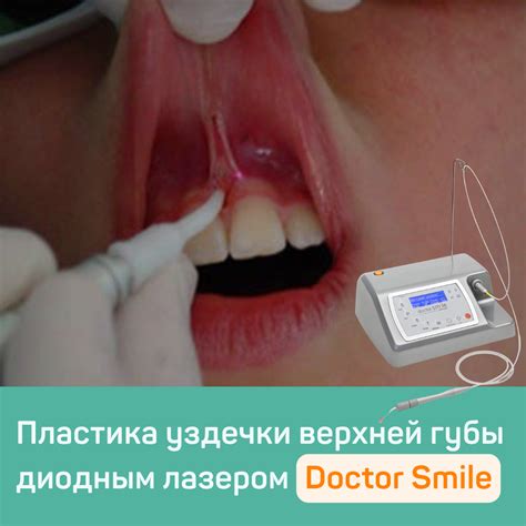Основные факторы и научное обоснование неспокойного состояния верхней губы