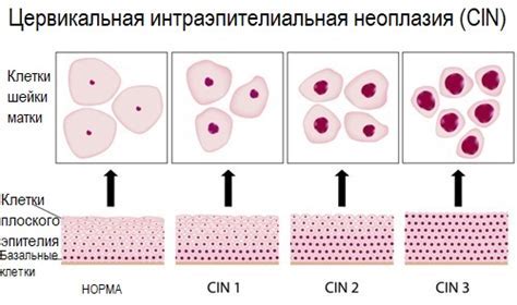 Основные характеристики гистологии без атипии