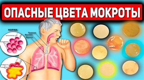 Основные характеристики мокроты у малышей: что стоит знать родителям
