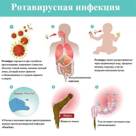 Основные шаги для успешного обращения с ротовирусной инфекцией у девятилетнего ребенка