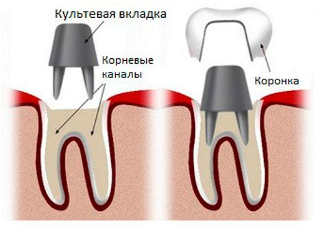 Основные этапы установки хвостовика на коронку