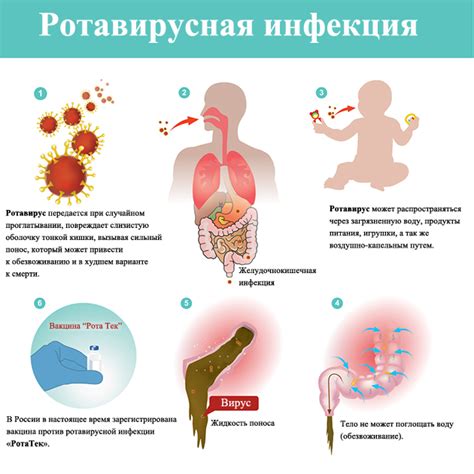 Особенности и характеристики ротовирусной инфекции у детей в возрасте 9 лет