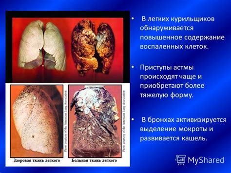 Особенности мокроты у курильщиков