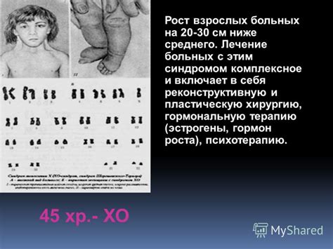 Особенности психологии людей с 47 хромосомами