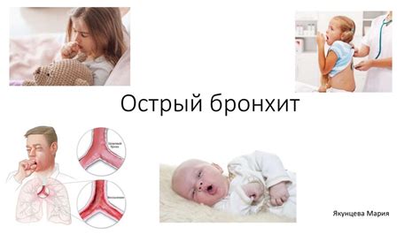 Острый и хронический бронхит - распространенные проблемы у детей