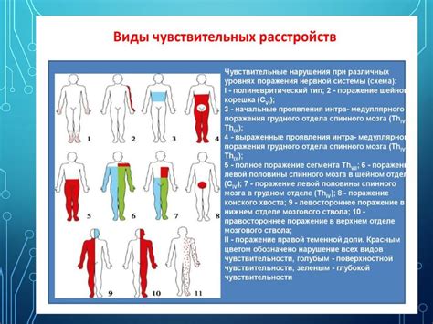 Отменные нарушения чувствительности