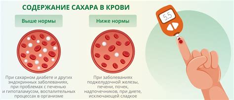 Отражение уровня сахара в крови
