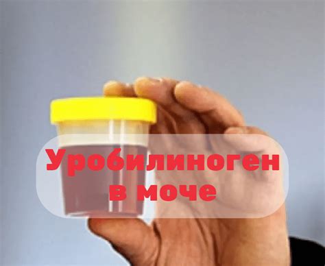 Отрицательный уробилиноген в моче: значения и причины