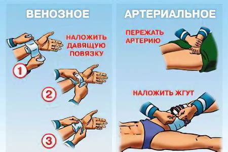 Оценка наличия кровотечений у пострадавшего
